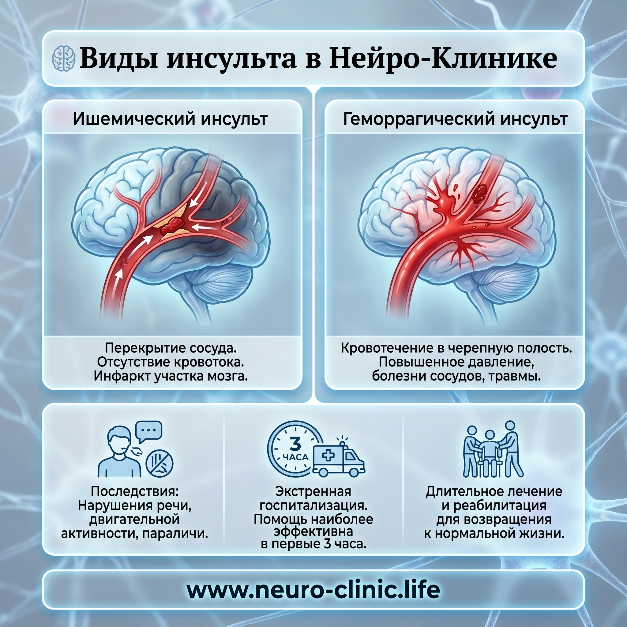 Виды инсульта